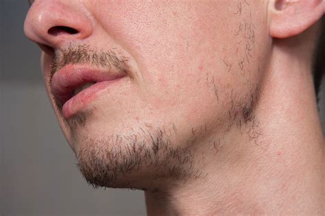 Cómo estimular el crecimiento de la barba Hondudiario Primer