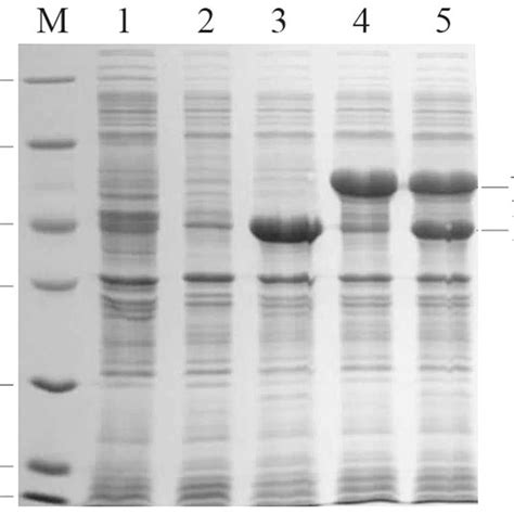 Sds Page Analysis Of Recombinant E Coli Lane M Marker Proteins Lane