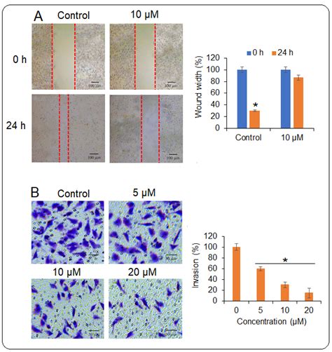 Isoalantolactone Inhibits The Migration And Invasion Of HEC 1 B Cells