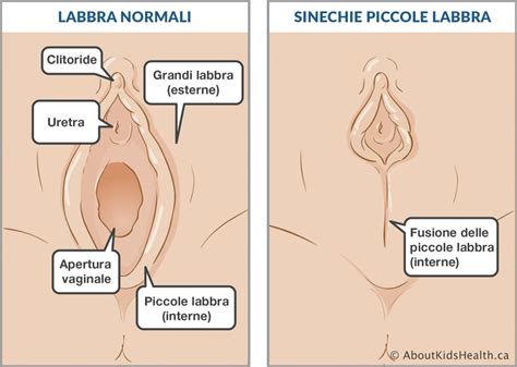 Avanzate Folla Moderatore Prurito Ingresso Vulva Un Milione Supporto