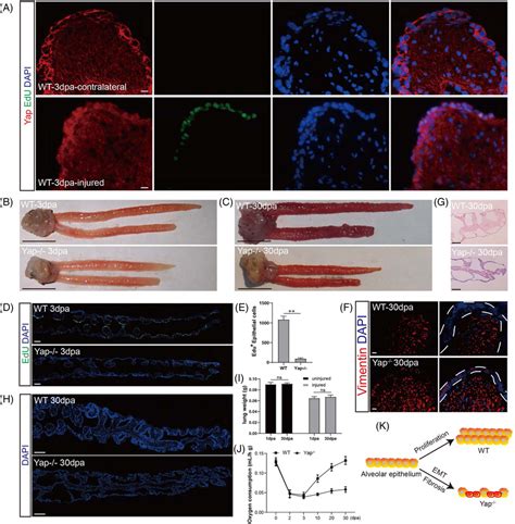 Yap deletion inhibits epithelial cell proliferation and respiratory ... 