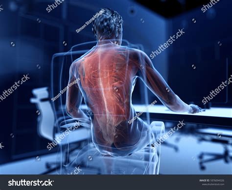 Illustration Office Workers Painful Muscles Stock Illustration ...