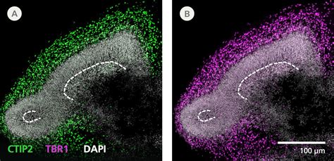 Stemdiff Cerebral Organoid Maturation Kit Stemcell Technologies