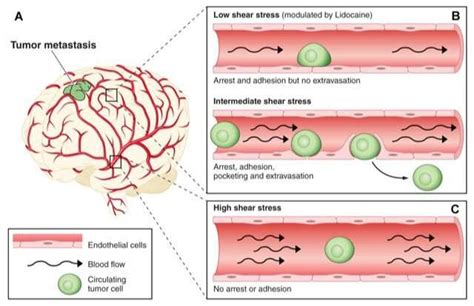 Blood Flow Is A Major Influence On Tumor Cell Metastasis