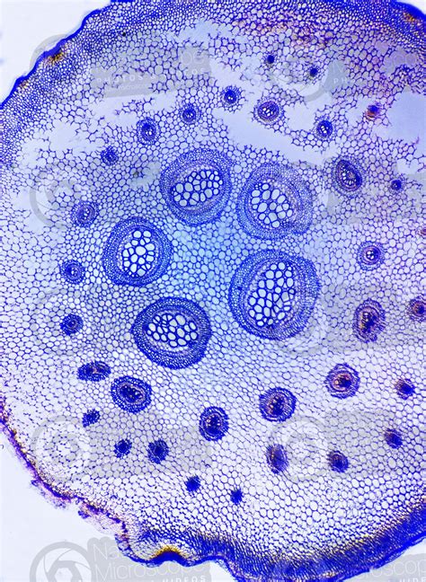 Fern Rhizome Dictyostele Transverse Section 50x Ferns Ferns