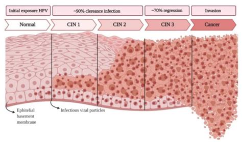 Cells Free Full Text A Systematic Review Of Micrornas Involved In