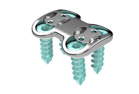 Origin™ Anterior Cervical Plate