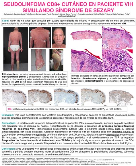 PDF SEUDOLINFOMA CD8 CUTÁNEO EN PACIENTE VIH SIMULANDO SÍNDROME DE