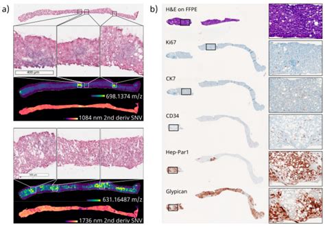 Cancers Free Full Text Spatial Omics Imaging Of Fresh Frozen Tissue And Routine Ffpe