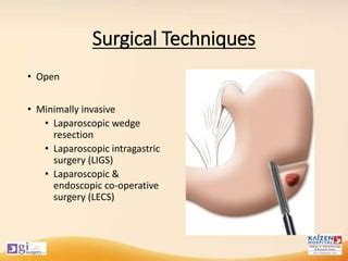 Gastric Gist By Dr Harsh Shah Gastroclinix Ppt