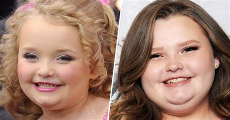 I Had Weight Loss Surgery Here S What Honey Boo Boo And Everyone Gets Wrong About It Artofit