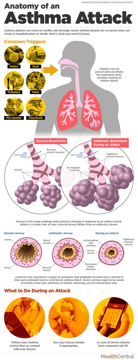 How Exactly Does An Asthma Attack Affect Your Lungs This Infographic Takes A Closer Look And