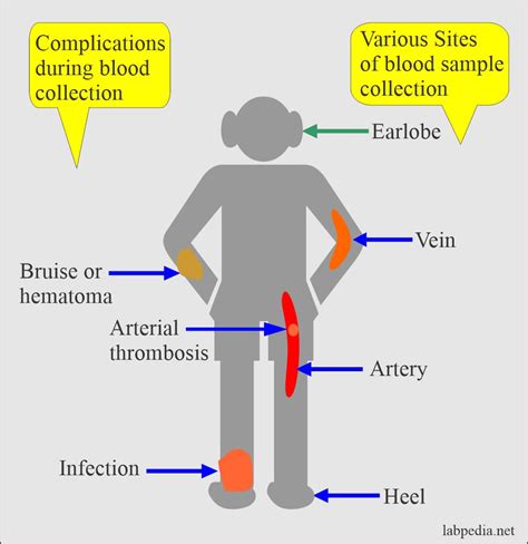 Blood Sample: – Part 1 – Complications during blood collection and Treatment – Labpedia.net