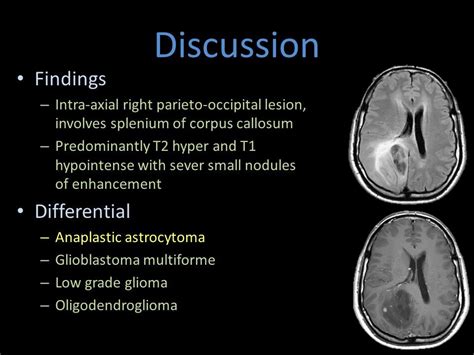 Pin By Aleksandra Stawik On Medyczne Mri Brain Radiography Corpus