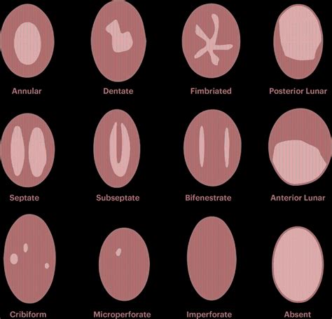 The Different Types Of Hymen Youre Not Popping Anything Lovense