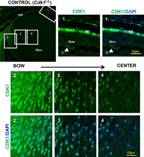 Cdk Protein Expression In Normal Lens Epithelial Cells And Fiber