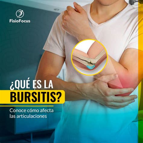 Bursitis Cuáles son las causas y síntomas Cómo prevenir FisioFocus