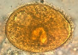 Intestinal Flagellates And Ciliates Flashcards Quizlet