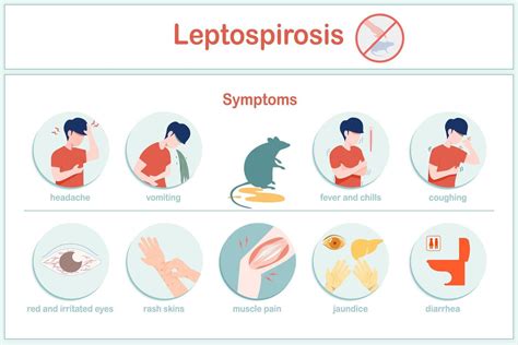 Vector Illustrations Infographic Symptoms Of Leptospirosis Fever