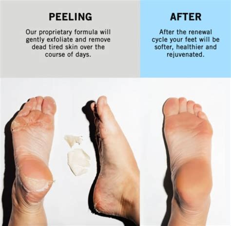 Feets Foot Peel Mask With Eucalyptus And Lavender 2 Pack Remove And