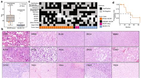 Age Sex Histopathology Immunohistochemistry Results A Patient Age Download Scientific