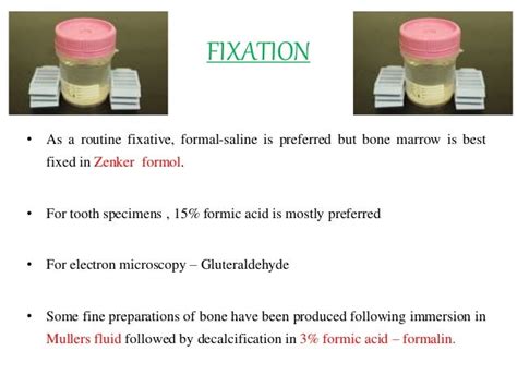 DECALCIFICATION