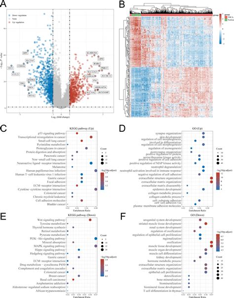 Screening For Differentially Expressed Genes DEGs In THCA And