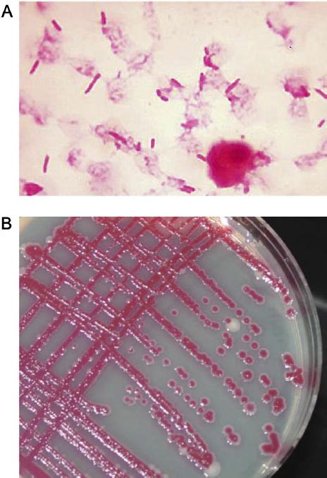 Serratia Marcescens Gram Stain