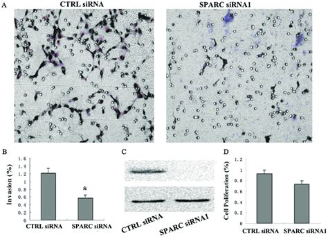 Silencing The Expression Of SPARC By RNAi Resulted In Decreased