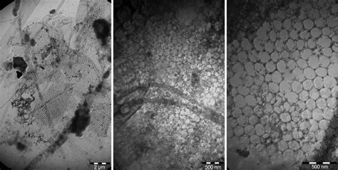 Transmission Electron Microscopy Images Of The Mucus Aggregates From