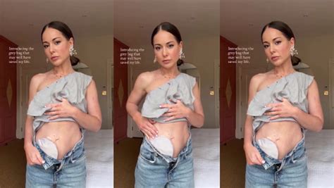 Louise Thompson Reveals She Has Had Lifesaving Stoma Bag Fitted