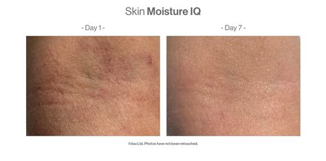 ADVANCED NUTRITION PROGRAMME SKIN MOISTURE IQ RÖ Skin