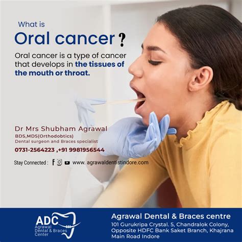 What Is Oral Cancer Symptoms Causes Treatment More