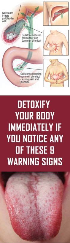 Detoxify Your Body Immediately If You Notice Any Of These 9 Warning