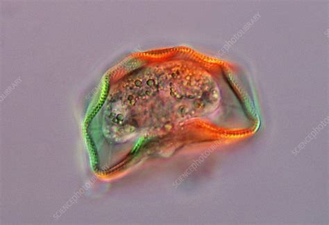 Shelled Amoeba Light Micrograph Stock Image C Science