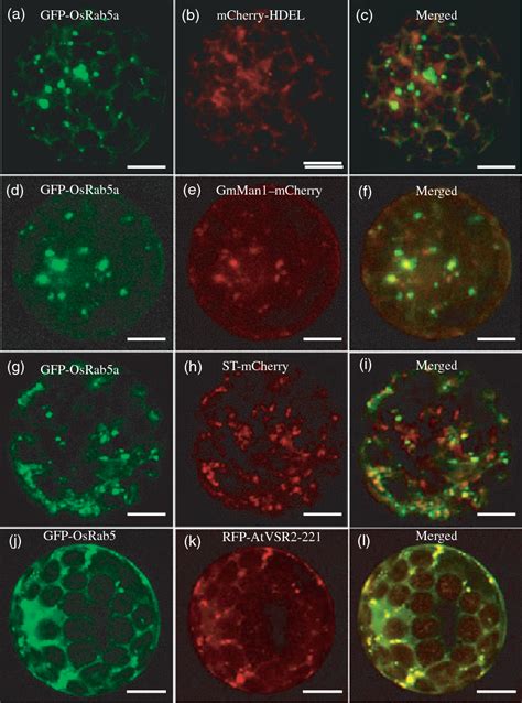 Figure From Osrab A Regulates Endomembrane Organization And Storage