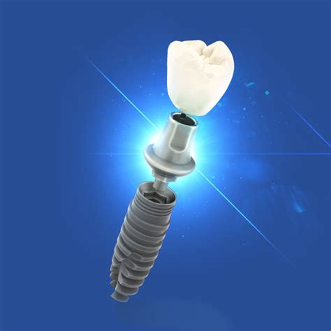 Dental Implant 3d Max