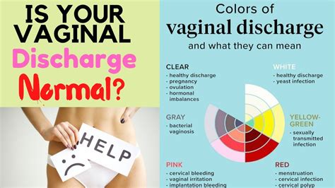 White Vaginal Discharge