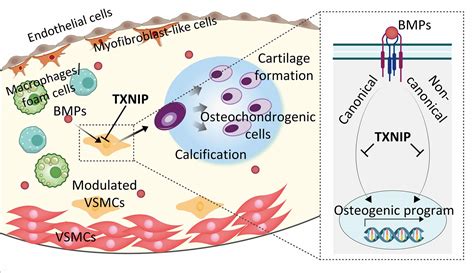 Txnip Suppresses The Osteochondrogenic Switch Of Vsmcs In