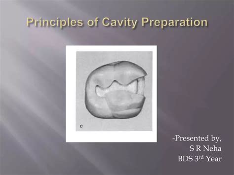 Principles Of Cavity Preparation PPT