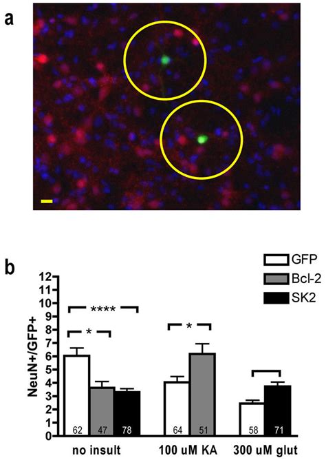 Increased number of NeuN+ cells within ~5 neuronal nuclei of a ...