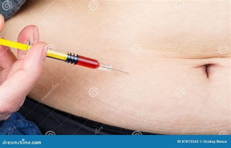 Method For Insulin Injection In The Abdomen