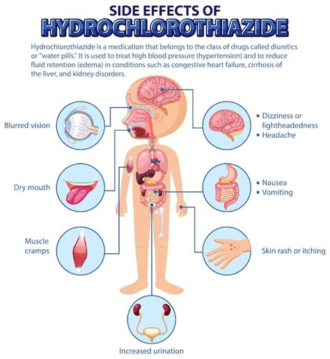 Menschliche Anatomie Diagramm Cartoon Stil Der Hydrochlorothiazid Seite