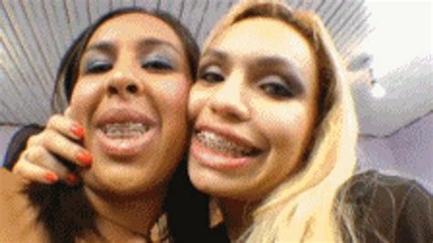 HOT AND GLUED KISSES WITH DENTAL APPLIANCE SABRINA SENNA NATASHA FERRARI FULL VERSION