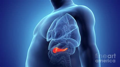 Obese Mans Pancreas Photograph By Sebastian Kaulitzkiscience Photo