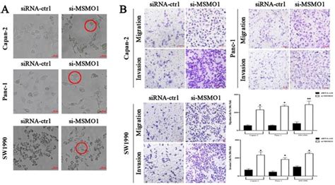 Down Regulation Of MSMO1 Promotes The Development And Progression Of