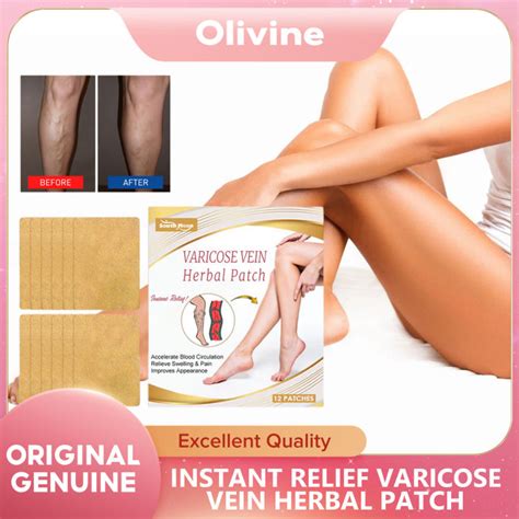 South Moon Varicose Veins Relief Patch Varicosity Patches Blood Vessel