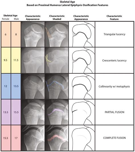 View of Estimating Skeletal Age in Children: A Comprehensive Anatomic