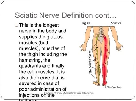 How To Get Rid Of Pinched Sciatic Nerve Pain And Get Relief From Sciati