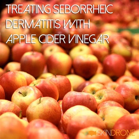 Seborrheic Dermatitis And The Potential Use Of Apple Cider Vinegar Skindrone